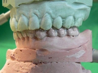 Zahnrztliche Fortbildung: Analysegang (Teil 3)